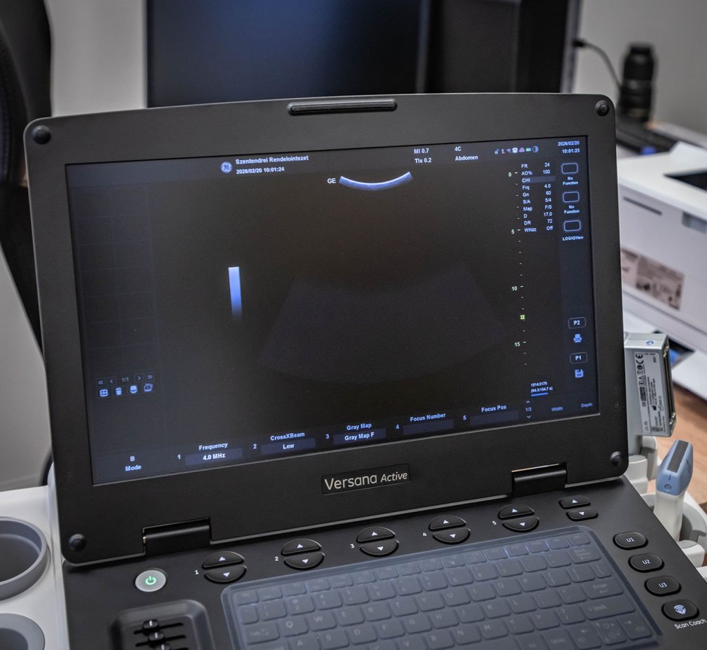 Korszerű, hordozható ultrahangkészülékkel bővítette eszközparkját a SZEI