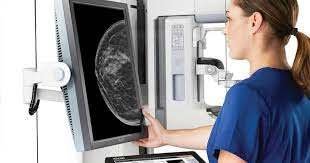 Mammográfiás szűrővizsgálat